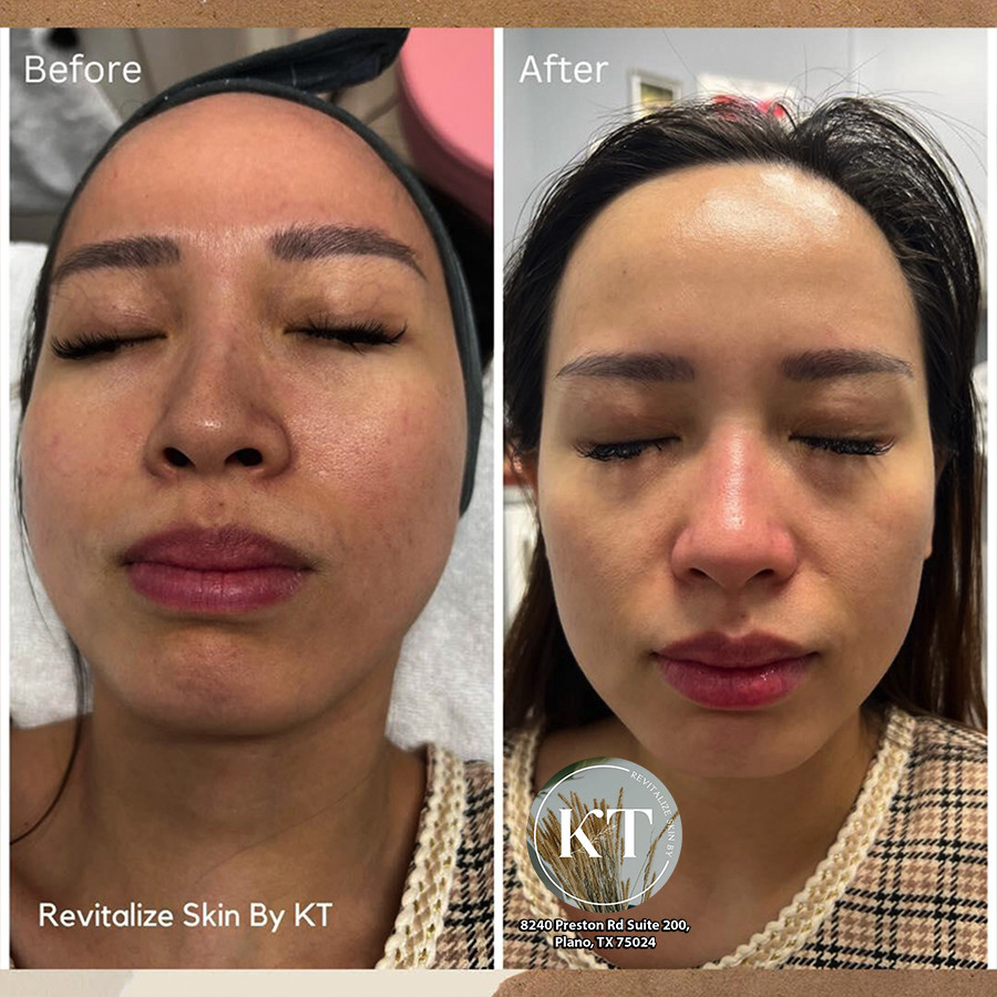 REVITALIZE SKIN BY KT - Best day spa Plano, TX 75024